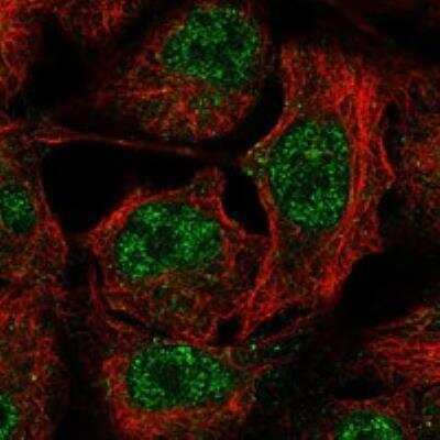 Immunocytochemistry/ Immunofluorescence: STARD3 Antibody [NBP3-17314]