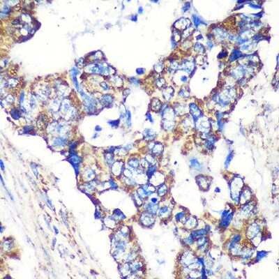 Immunohistochemistry-Paraffin: STARD3NL Antibody - Azide and BSA Free [NBP2-94673]