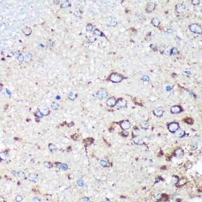 Immunohistochemistry-Paraffin: STARD3NL Antibody - Azide and BSA Free [NBP2-94673]