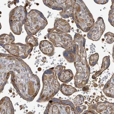 Immunohistochemistry-Paraffin: STARD4 Antibody [NBP2-30538]