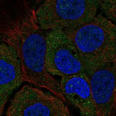 Immunocytochemistry/ Immunofluorescence: STARD5 Antibody [NBP1-92448]