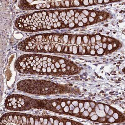 Immunohistochemistry-Paraffin: STARD5 Antibody [NBP1-92448]