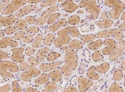 Immunohistochemistry-Paraffin: STARD5 Antibody [NBP3-05985]