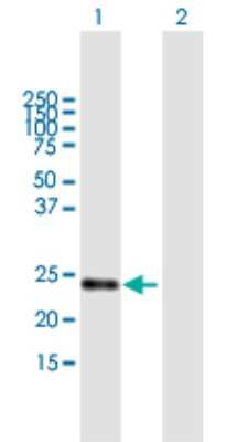 Western Blot: STARD5 Antibody [H00080765-B02P]