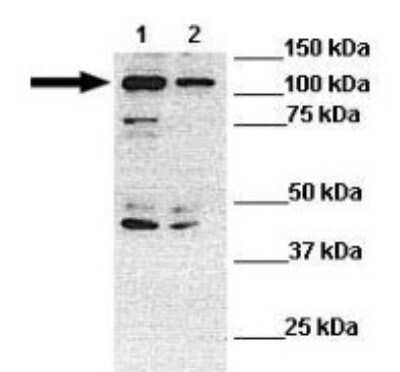 Western Blot: STARD8 Antibody [NBP1-69097]