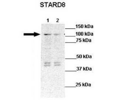 Western Blot: STARD8 Antibody [NBP1-69098]