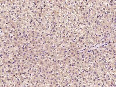 Immunohistochemistry-Paraffin: START domain containing 7 Antibody [NBP2-97964]