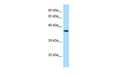 Western Blot: START domain containing 7 Antibody [NBP2-88369]