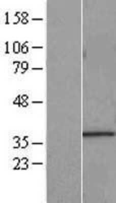 Western Blot: START domain containing 7 Overexpression Lysate [NBL1-16521]