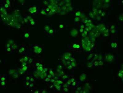 Immunocytochemistry/ Immunofluorescence: STAT1 Antibody (OTI4H9) [NBP1-48011]