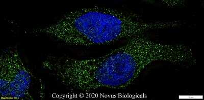 Immunocytochemistry/ Immunofluorescence: STAT1 Antibody [NB100-56314]