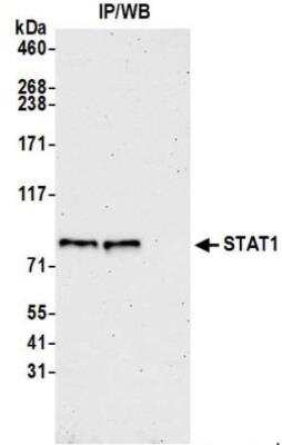 Immunoprecipitation: STAT1 Antibody (BLR125H) [NBP3-14708]