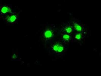 Immunocytochemistry/ Immunofluorescence: STAT1 Antibody (OTI15H3) - Azide and BSA Free [NBP2-74377]