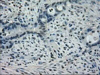 Immunohistochemistry: STAT1 Antibody (OTI15H3) - Azide and BSA Free [NBP2-74377]
