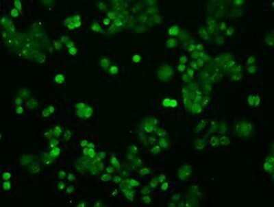 Immunocytochemistry/ Immunofluorescence: STAT1 Antibody (OTI4H9) - Azide and BSA Free [NBP2-74375]