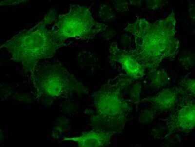 Immunocytochemistry/ Immunofluorescence: STAT1 Antibody (OTI4H9) - Azide and BSA Free [NBP2-74375]