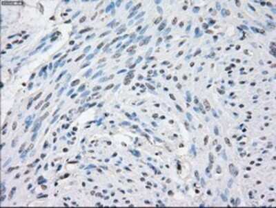 Immunohistochemistry: STAT1 Antibody (OTI4H9) - Azide and BSA Free [NBP2-74375]