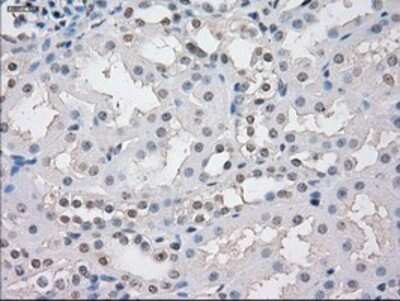 Immunohistochemistry: STAT1 Antibody (OTI4H9) - Azide and BSA Free [NBP2-74375]