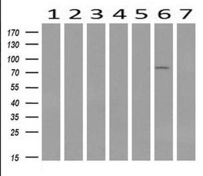 Western Blot: STAT1 Antibody (OTI4H9) [NBP1-48011]