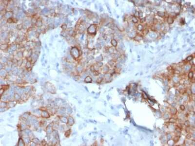 Immunohistochemistry-Paraffin: STAT2 Antibody (STAT2/2650) - Azide and BSA Free [NBP3-08587]