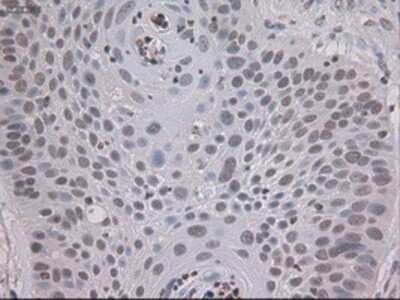 Immunohistochemistry-Paraffin: STAT3 Antibody (OTI21E7) [NBP1-48014]