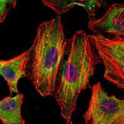 Immunocytochemistry/ Immunofluorescence: STAT3 Antibody (3B5) - BSA Free [NBP1-51667]