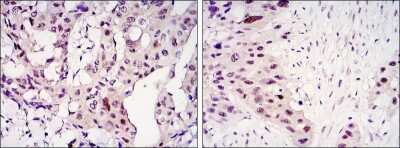 Immunohistochemistry-Paraffin: STAT3 Antibody (3B5) - BSA Free [NBP1-51667]