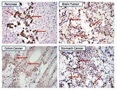 Immunohistochemistry-Paraffin: STAT3 Antibody (9D8) [NBP2-22471]