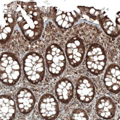 Immunohistochemistry-Paraffin: STAT3 Antibody (CL0492) [NBP2-52936]