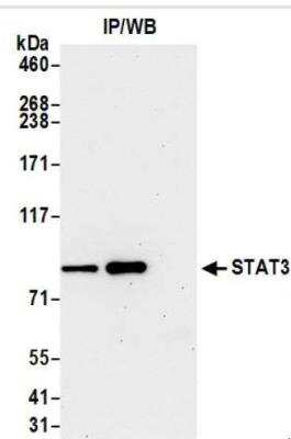 Immunoprecipitation: STAT3 Antibody (BLR098G) [NBP3-14691]