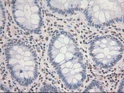 Immunohistochemistry: STAT3 Antibody (OTI21E7) - Azide and BSA Free [NBP2-74378]