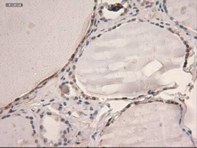 Immunohistochemistry: STAT3 Antibody (OTI21E7) - Azide and BSA Free [NBP2-74378]