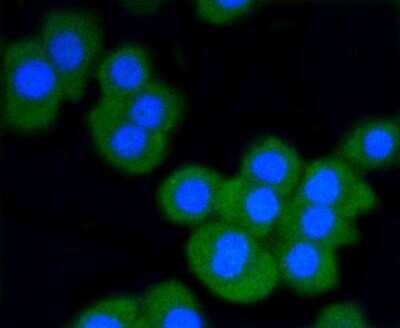 Immunocytochemistry/ Immunofluorescence: STAT3 Antibody (SY24-08) [NBP2-67432]