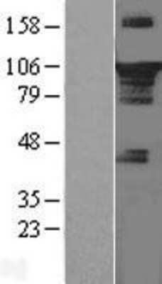 Western Blot: STAT3 Overexpression Lysate [NBL1-16526]
