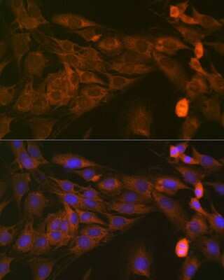 Immunocytochemistry/ Immunofluorescence: STAT4 Antibody (10H10O9) [NBP3-16425]