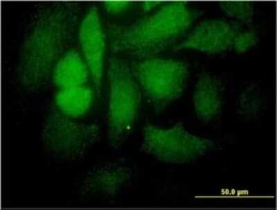 Immunocytochemistry/ Immunofluorescence: STAT4 Antibody (1C2-1C12) [H00006775-M01]