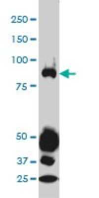 Western Blot: STAT4 Antibody (1C2-1C12) [H00006775-M01]