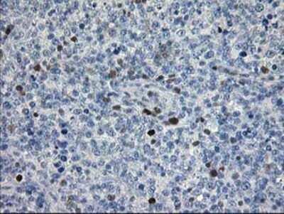 Immunohistochemistry-Paraffin: STAT4 Antibody (OTI2F3) [NBP2-00851]