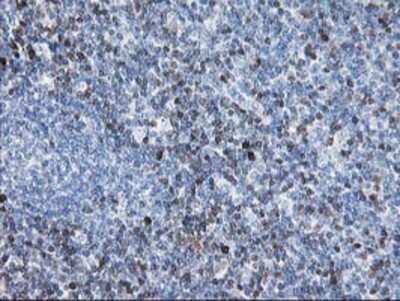 Immunohistochemistry: STAT4 Antibody (OTI2F3) - Azide and BSA Free [NBP2-74389]