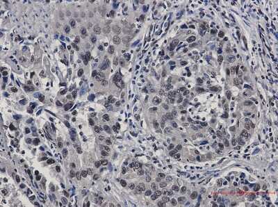 Immunohistochemistry-Paraffin: STAT4 Antibody (S02-1C1) [NBP3-14977]