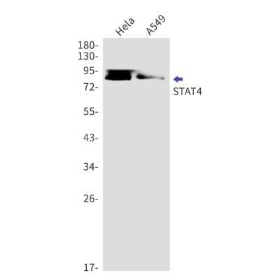 Western Blot: STAT4 Antibody (S02-1C1) [NBP3-14977]