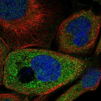 Immunocytochemistry/ Immunofluorescence: STAT5A Antibody [NBP1-81051]