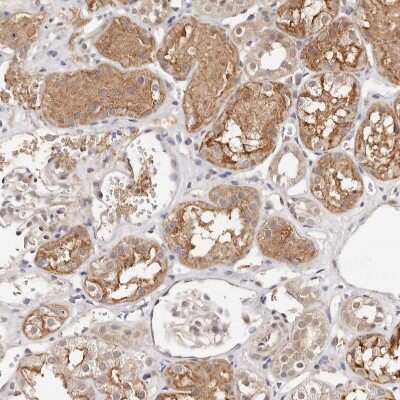 Immunohistochemistry-Paraffin: STAT5A Antibody [NBP1-81051]