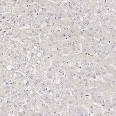 Immunohistochemistry-Paraffin: STAT5A Antibody [NBP1-81051]