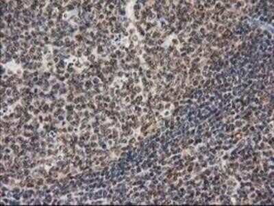 Immunohistochemistry: STAT5A Antibody (OTI9F7) - Azide and BSA Free [NBP2-74392]