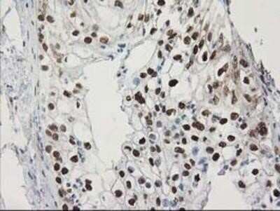 Immunohistochemistry-Paraffin: STAT5A Antibody (OTI9F7) [NBP2-00622]