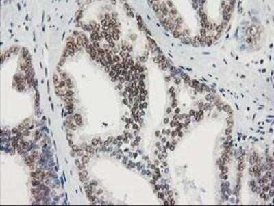 Immunohistochemistry-Paraffin: STAT5A Antibody (OTI9F7) [NBP2-00622]