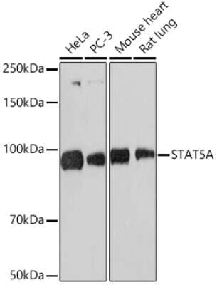 Western Blot: STAT5a/b Antibody (3J2A2) [NBP3-16533]