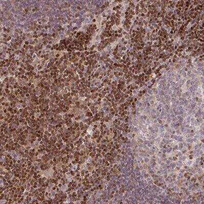 Immunohistochemistry: STAT5A Antibody [NBP2-46669]
