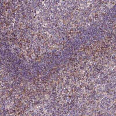 Immunohistochemistry: STAT5A Antibody [NBP2-46777]